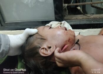 दोन वर्षीय बालिकेला बिबट्याने मानेला पंजात पकडत फरटत ओढून नेले,आई भिडली बिबट्याशी