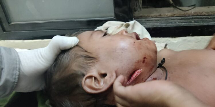 दोन वर्षीय बालिकेला बिबट्याने मानेला पंजात पकडत फरटत ओढून नेले,आई भिडली बिबट्याशी