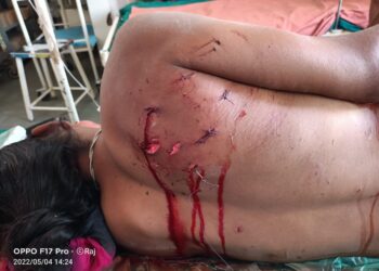 बिबट्याच्या प्राणघातक हल्ल्यात युवक गंभीर जखमी