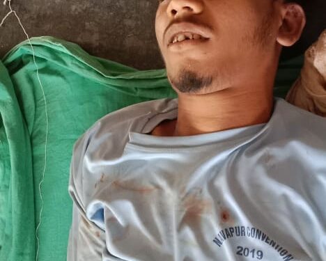 शेतात पाण्याची मोटार बोरिंग मध्ये टाकत असताना 18 वर्षीय युवकाचा दुर्दैवी मृत्यू