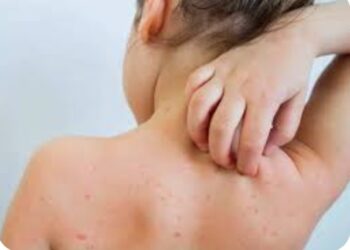 जिल्ह्यात आजपासून गोवर रुबेला विशेष लसीकरण मोहीम