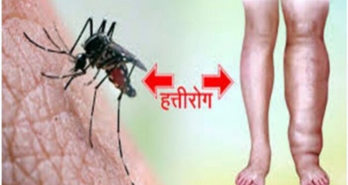 नवापुर तालुक्यात हत्तीरोग नियंत्रणासाठी सामुदायिक औषधोपचार मोहिम सुरु