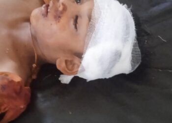 चिखली शिवारात बिबट्याच्या दोन बालकांवर हल्ला, दोघांवर उपचार सुरू