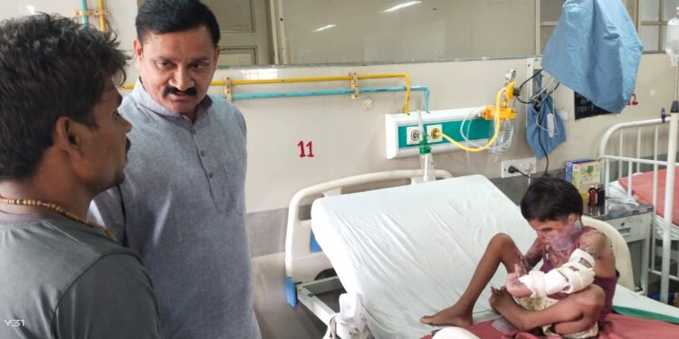 आमदार राजेश पाडवी यांनी दिला 46 टक्के जळालेला रुग्णाला दिलासा